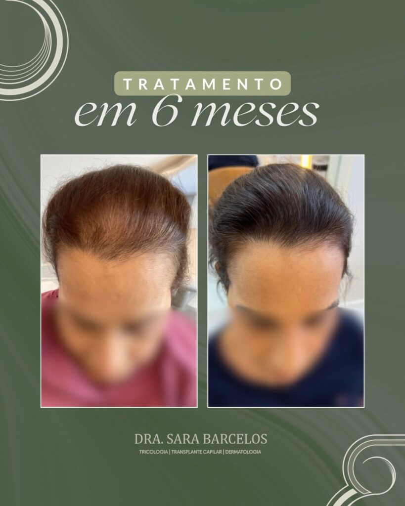✨ Resultado de 6 meses que começa com um diagnóstico correto.Essa paciente chegou até mim já fru (1)