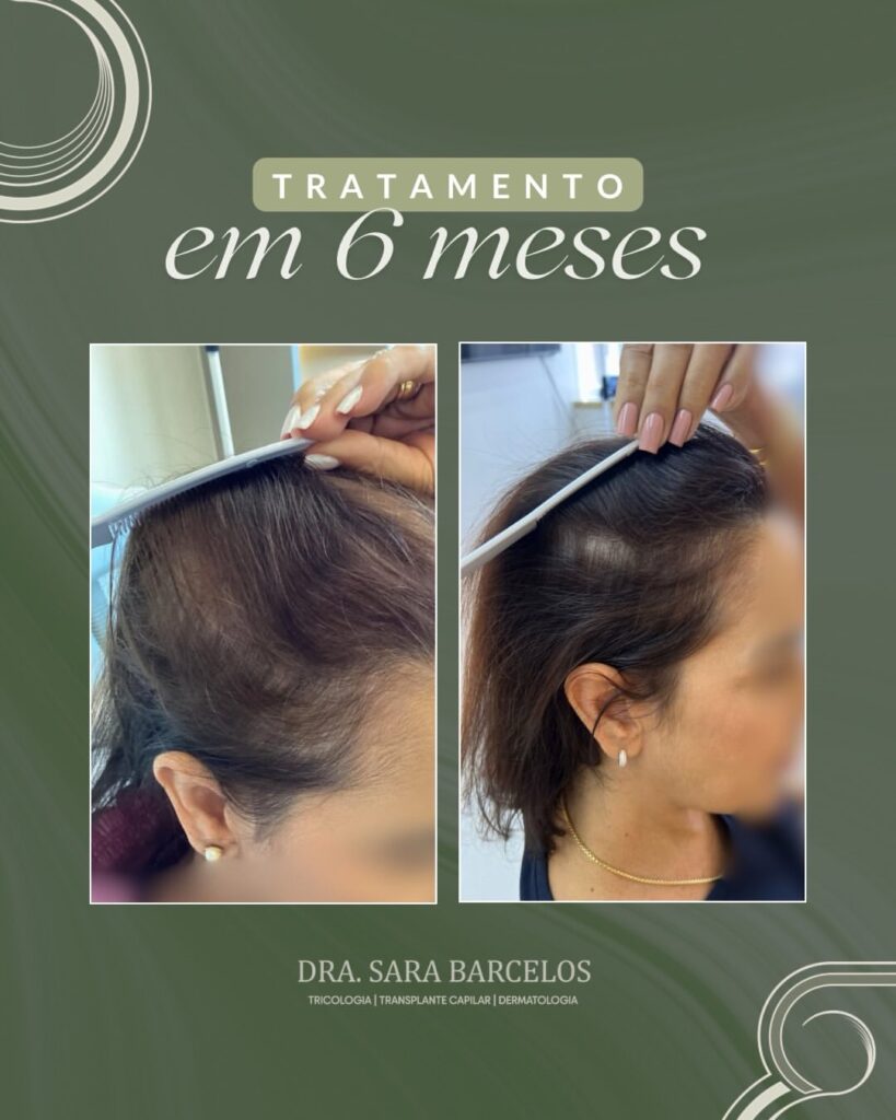 ✨ Resultado de 6 meses que começa com um diagnóstico correto.Essa paciente chegou até mim já fru (2)